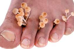 Польза Feet protect в быстром устранении симптомов.