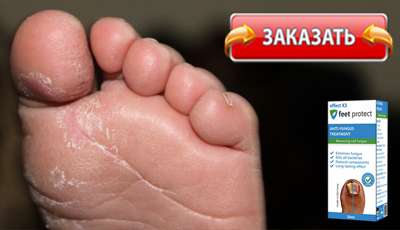 Feet protect купить в аптеке.